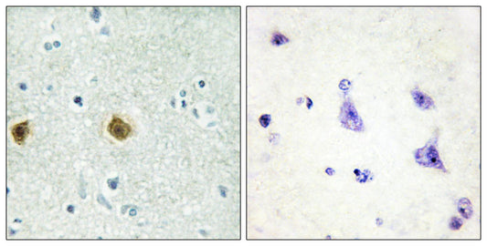 NDUFC2 Rabbit Polyclonal Antibody