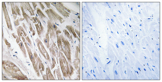 NDUFS5 Rabbit Polyclonal Antibody
