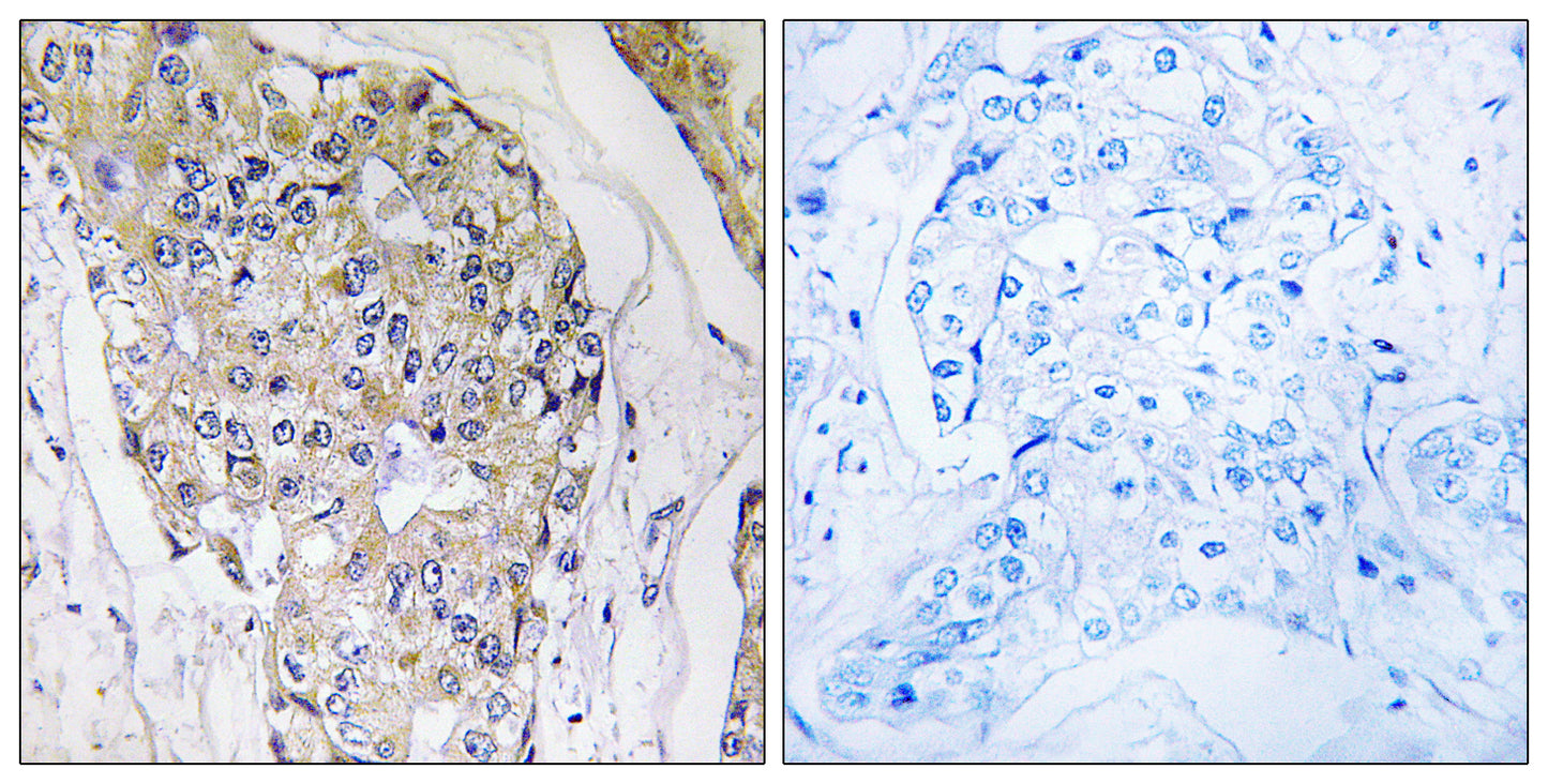 NDUFS6 Rabbit Polyclonal Antibody