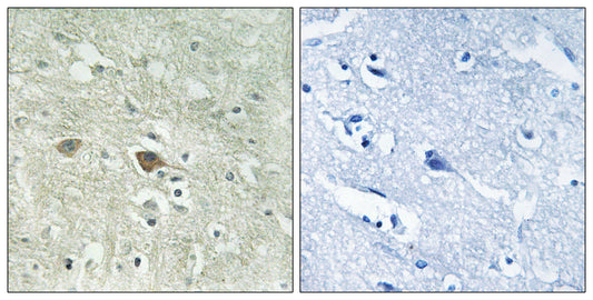 NDUFV3 Rabbit Polyclonal Antibody