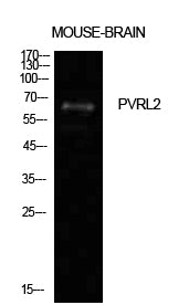Nectin 2 Rabbit Polyclonal Antibody