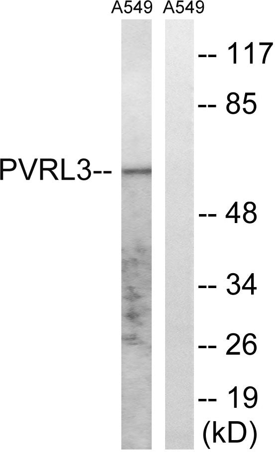 Nectin 3 Rabbit Polyclonal Antibody
