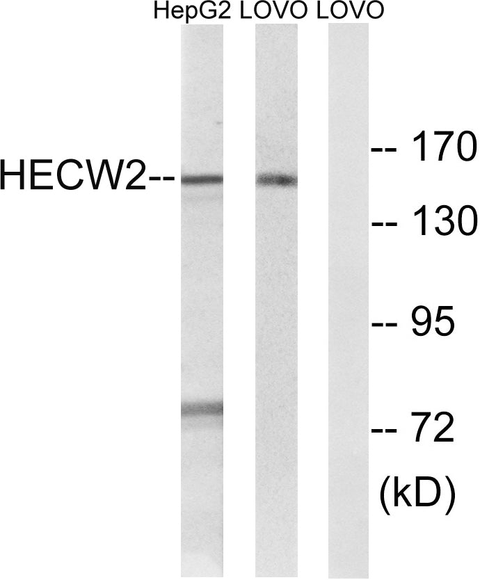 NEDL2 Rabbit Polyclonal Antibody