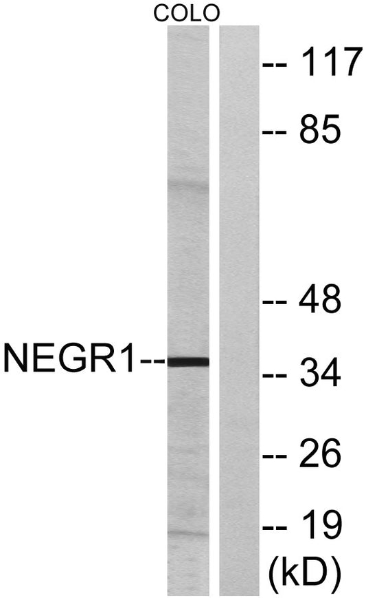 NEGR1 Rabbit Polyclonal Antibody