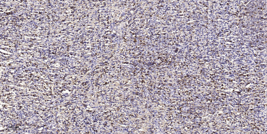 Nek4 Rabbit Polyclonal Antibody