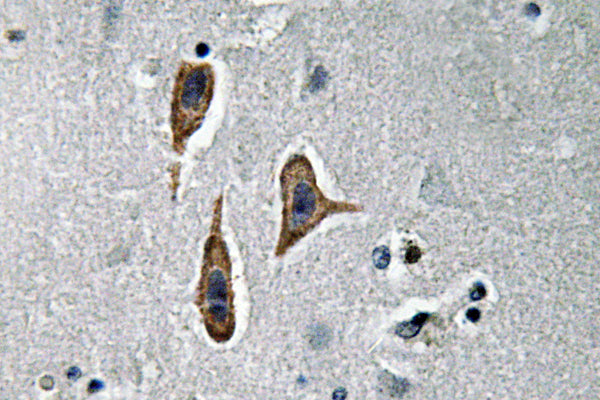 Nephrin Rabbit Polyclonal Antibody