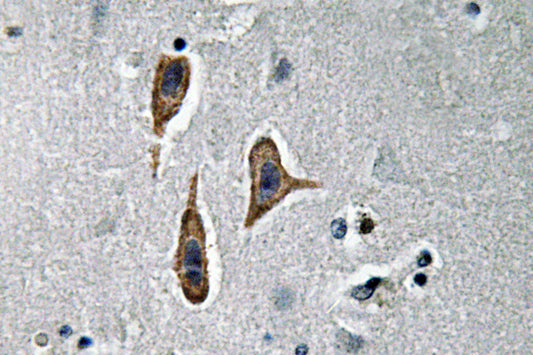 Nephrin Rabbit Polyclonal Antibody