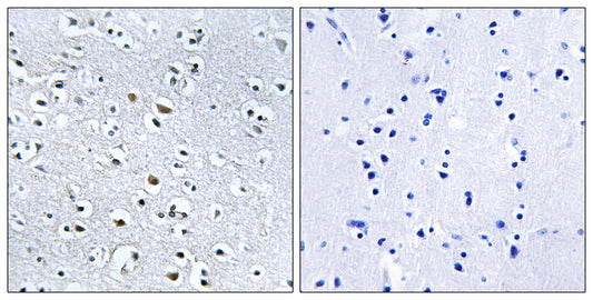 Nephrocystin-4 Rabbit Polyclonal Antibody