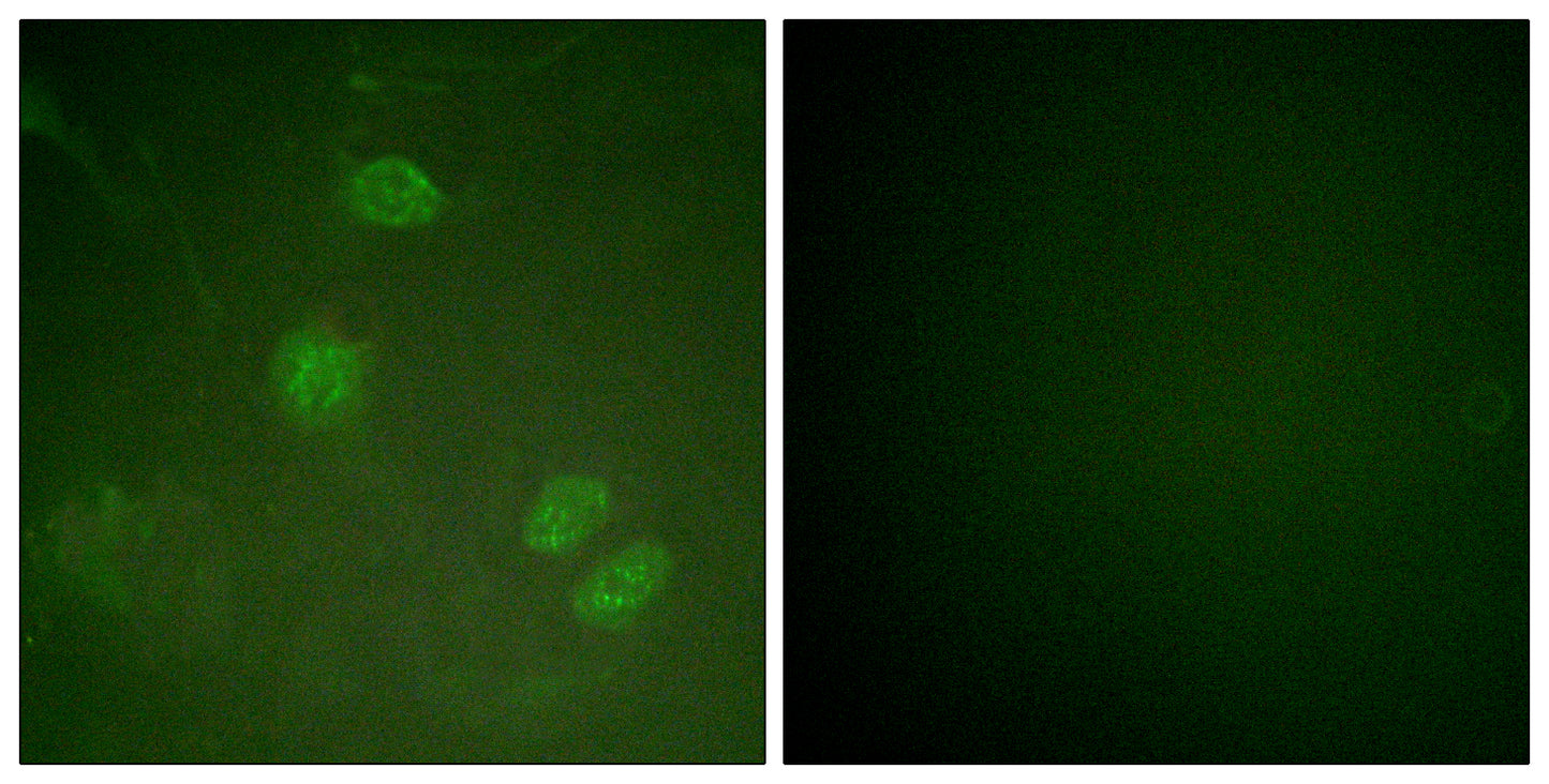 Net Rabbit Polyclonal Antibody