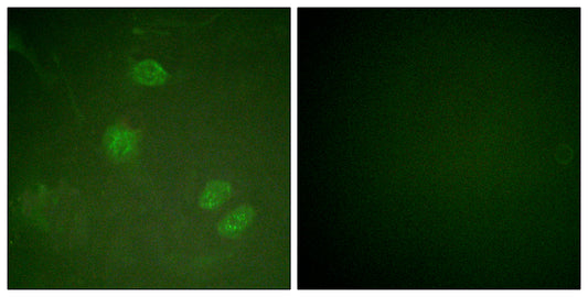 Net Rabbit Polyclonal Antibody