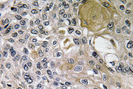 Netrin-1 Rabbit Polyclonal Antibody