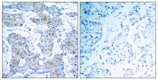 Neu Rabbit Polyclonal Antibody