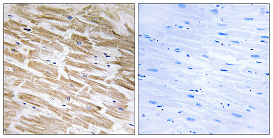 Neuralized-2 Rabbit Polyclonal Antibody