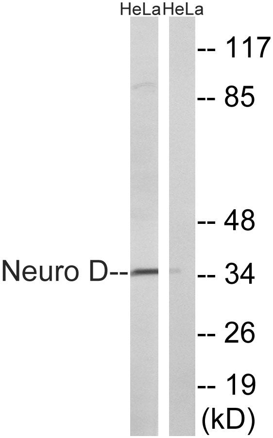Neuro D Rabbit Polyclonal Antibody