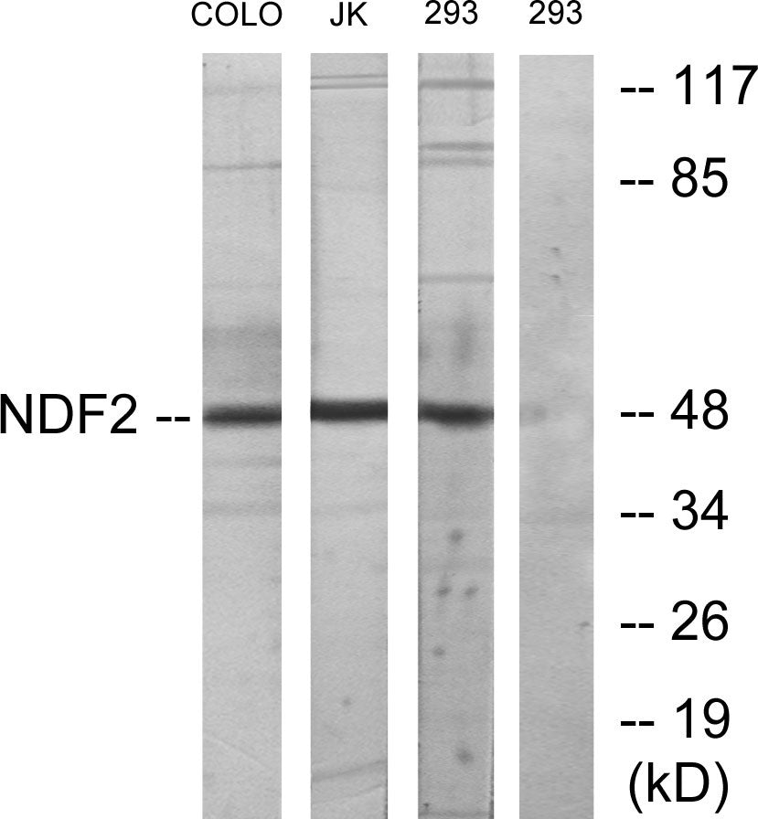 Neuro D2 Rabbit Polyclonal Antibody