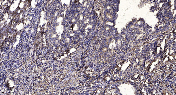 Neurocalcin δ Rabbit Polyclonal Antibody