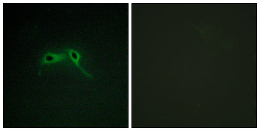 Neurofibromin Rabbit Polyclonal Antibody
