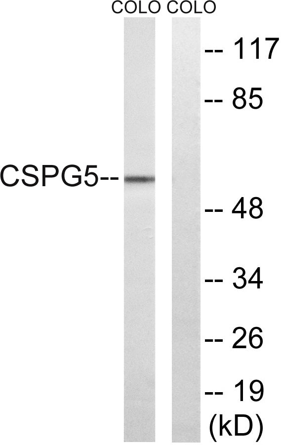 Neuroglycan C Rabbit Polyclonal Antibody