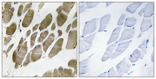 Neuromedin-U Rabbit Polyclonal Antibody
