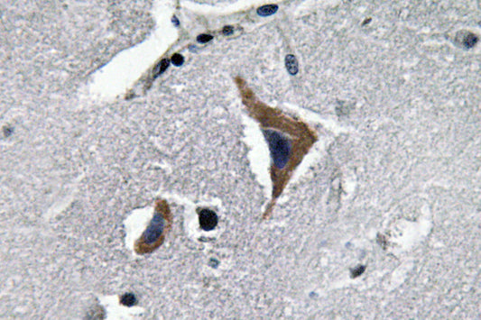 Neurophysin I Rabbit Polyclonal Antibody