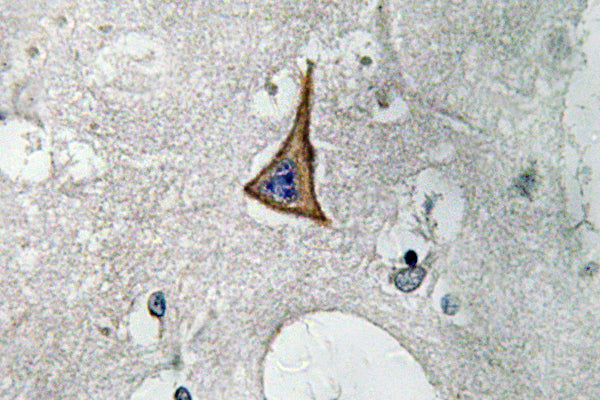 Neuropilin-1 Rabbit Polyclonal Antibody