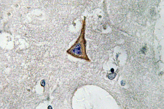 Neuropilin-1 Rabbit Polyclonal Antibody