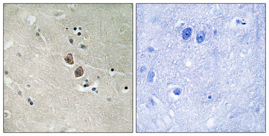 Neuroplastin Rabbit Polyclonal Antibody