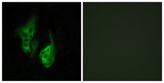 Neuropsin Rabbit Polyclonal Antibody
