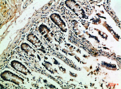 NFATc2 Rabbit Polyclonal Antibody