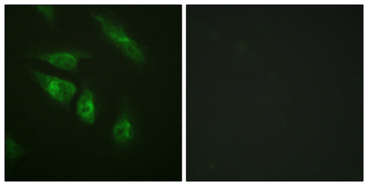 NFATc4 Rabbit Polyclonal Antibody