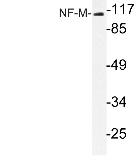 NF-M Rabbit Polyclonal Antibody