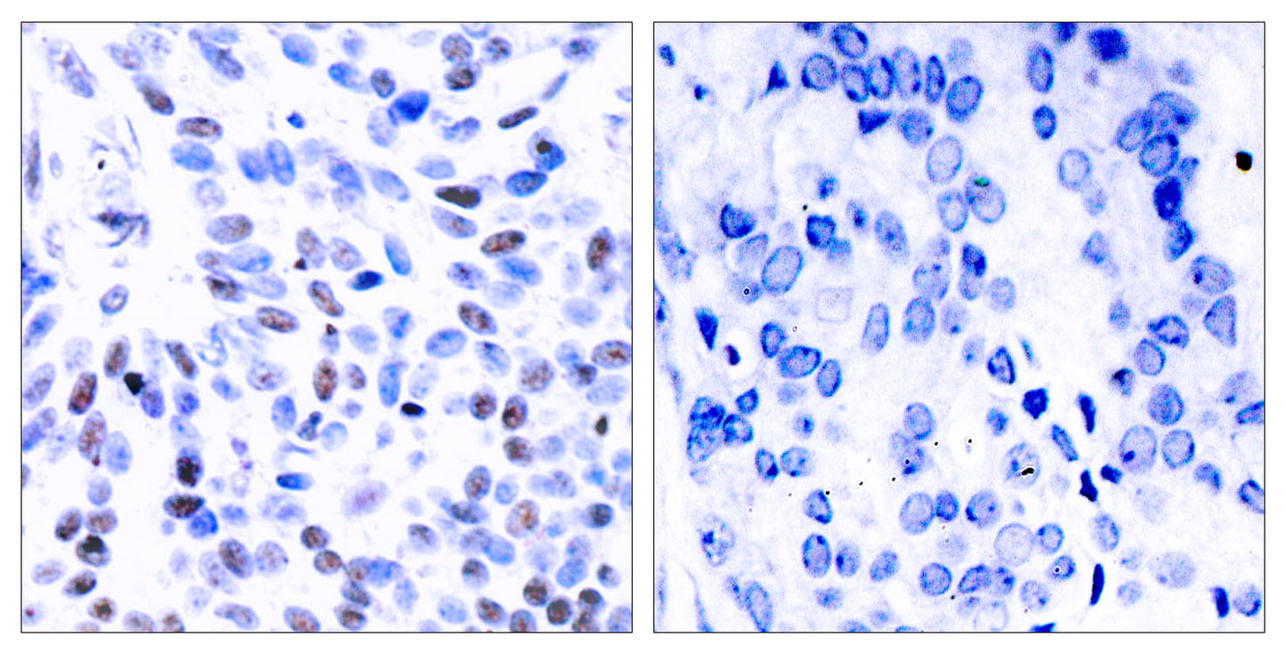 NFκB-p100 Rabbit Polyclonal Antibody