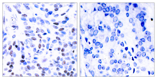 NFκB-p100 Rabbit Polyclonal Antibody