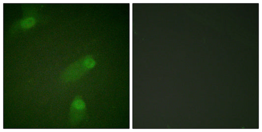 NFκB-p105 Rabbit Polyclonal Antibody