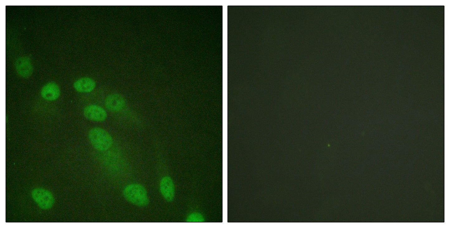 NFκB-p65 Rabbit Polyclonal Antibody