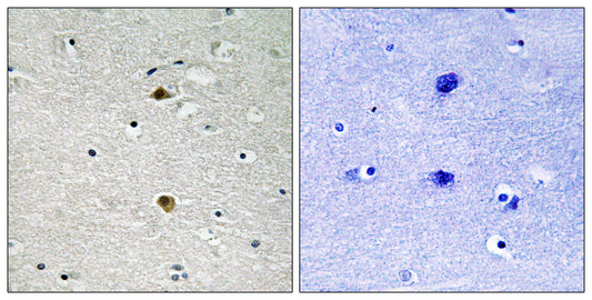 NFκB-p65 Rabbit Polyclonal Antibody