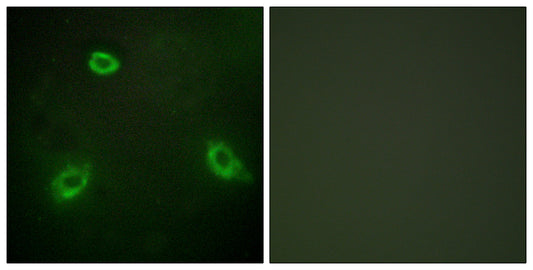 NGEP Rabbit Polyclonal Antibody