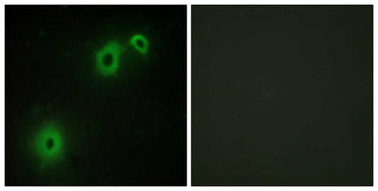 NGFR p75 Rabbit Polyclonal Antibody