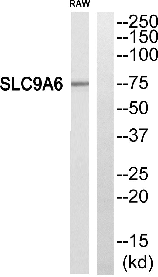NHE-6 Rabbit Polyclonal Antibody