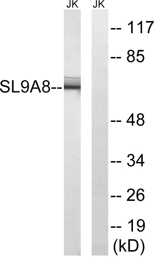NHE-8 Rabbit Polyclonal Antibody