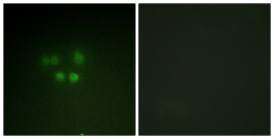 Nibrin Rabbit Polyclonal Antibody