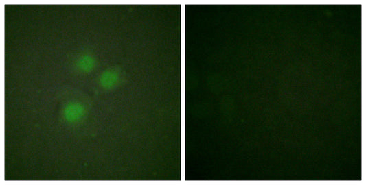 NIFK Rabbit Polyclonal Antibody