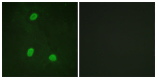 NIPA Rabbit Polyclonal Antibody