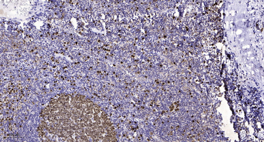 NIPBL Rabbit Polyclonal Antibody