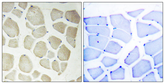 NKIAMRE Rabbit Polyclonal Antibody