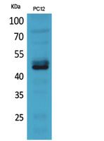 NKp44 Rabbit Polyclonal Antibody