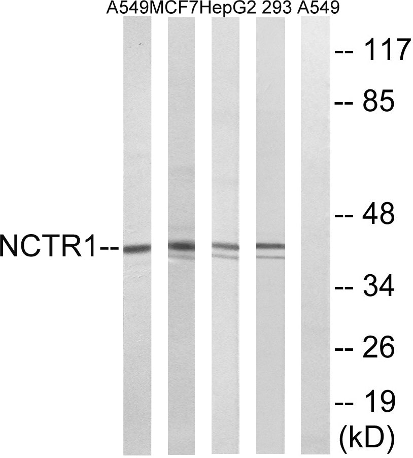 NKp46 Rabbit Polyclonal Antibody