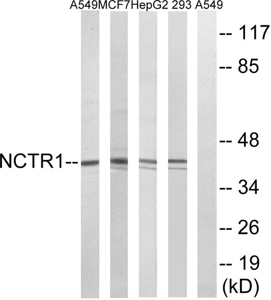 NKp46 Rabbit Polyclonal Antibody