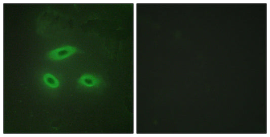 NK-TR Rabbit Polyclonal Antibody
