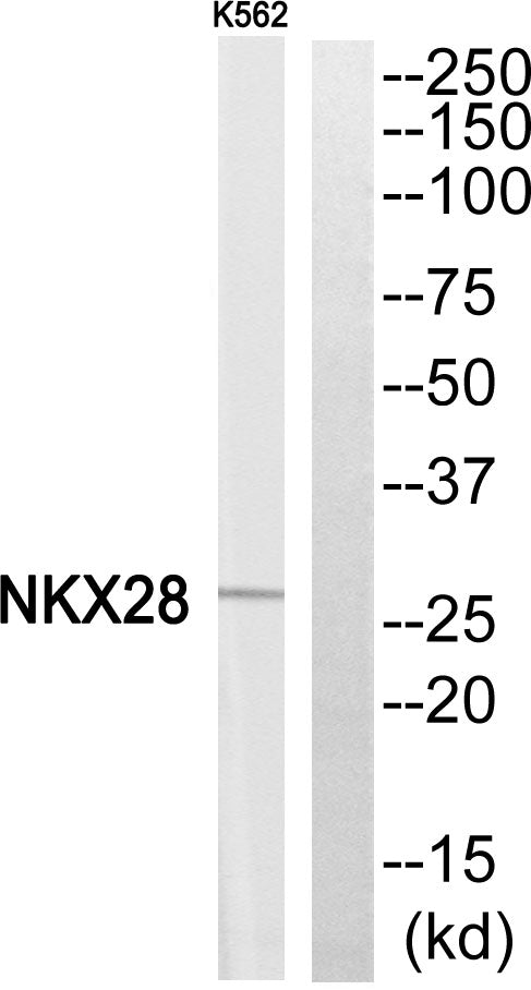 Nkx-2.8 Rabbit Polyclonal Antibody